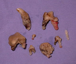 Teeth yucky (2)